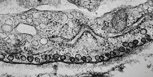M,22y. | normal heart, endothel, pinocytosis M,22y. | normal heart, endothel, pinocytosis